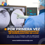 Por primera vez se realiza procedimiento de embolización de malformación arteriovenosa cerebral en Loja.